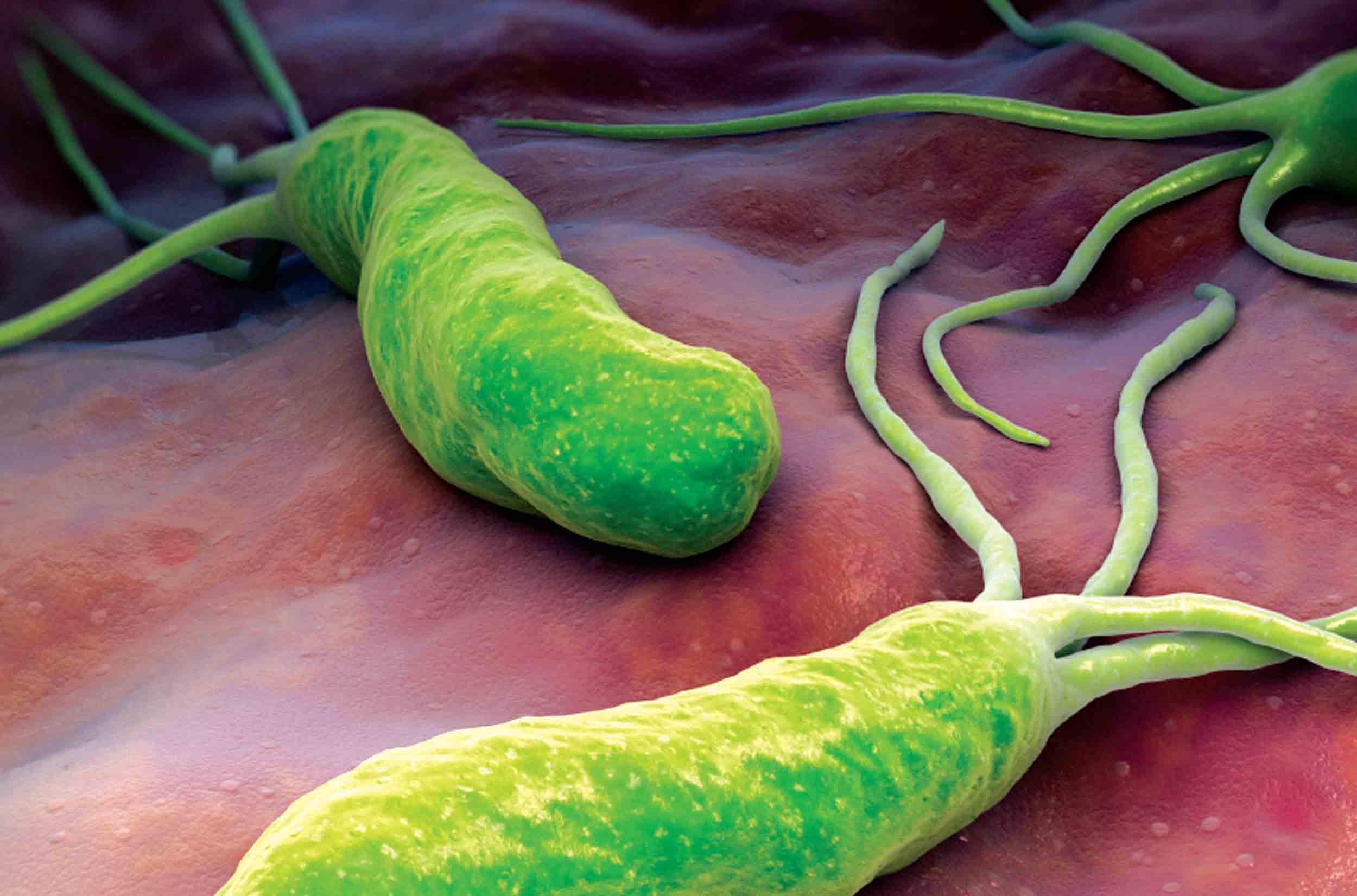 Vi khuẩn Hp dạ dày có thể gây hôi miệng